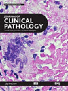 Journal Of Clinical Pathology杂志